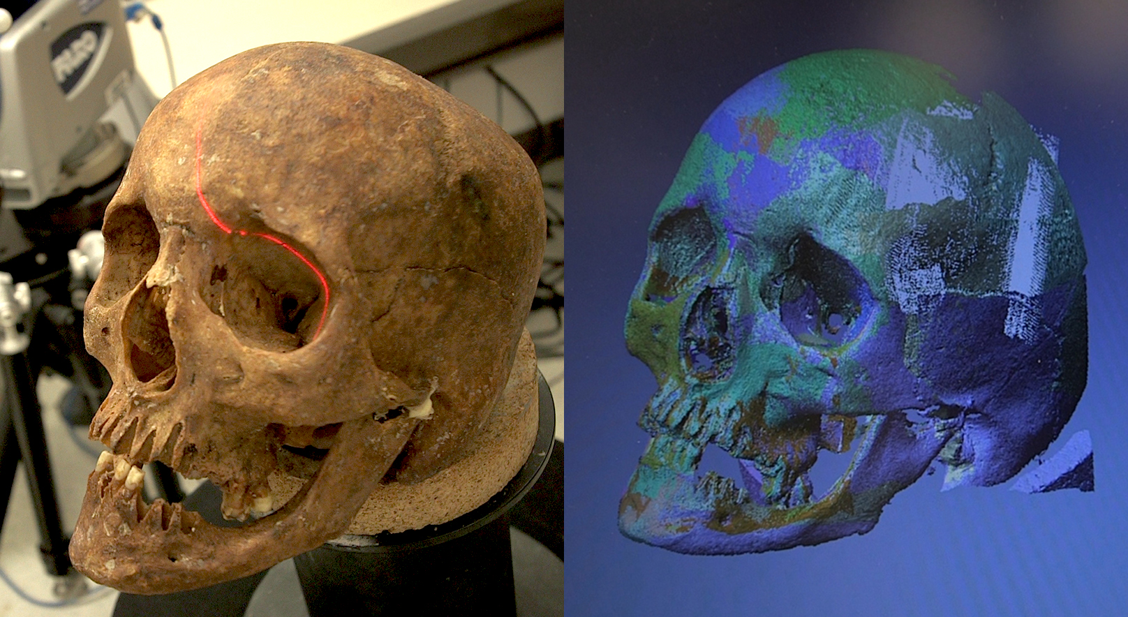 Skull and Digital Scan of Skull