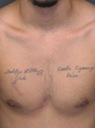 Tattoos and scar on chest