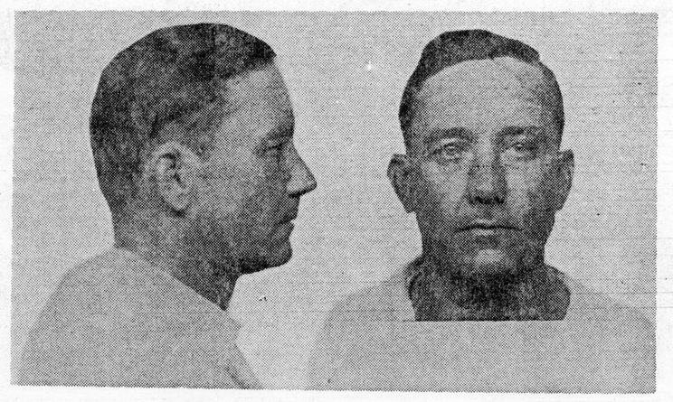 72. James William Lofton 72. James William Lofton